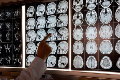 neurological disorders treatment